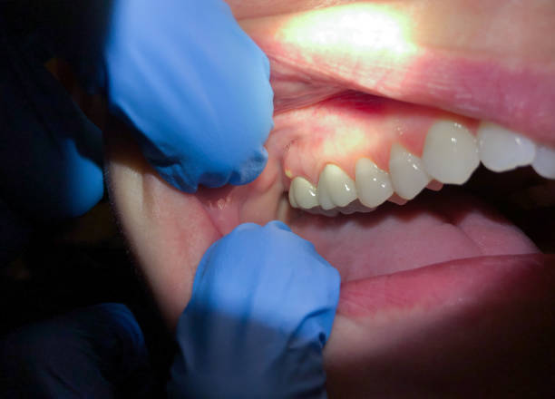 Best Emergency Dentist for Special Needs Patients in Mbria, CA